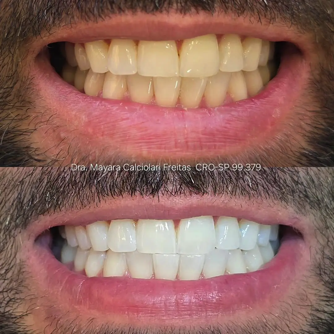 Dr-Mayara-Odontologia-Estetica5