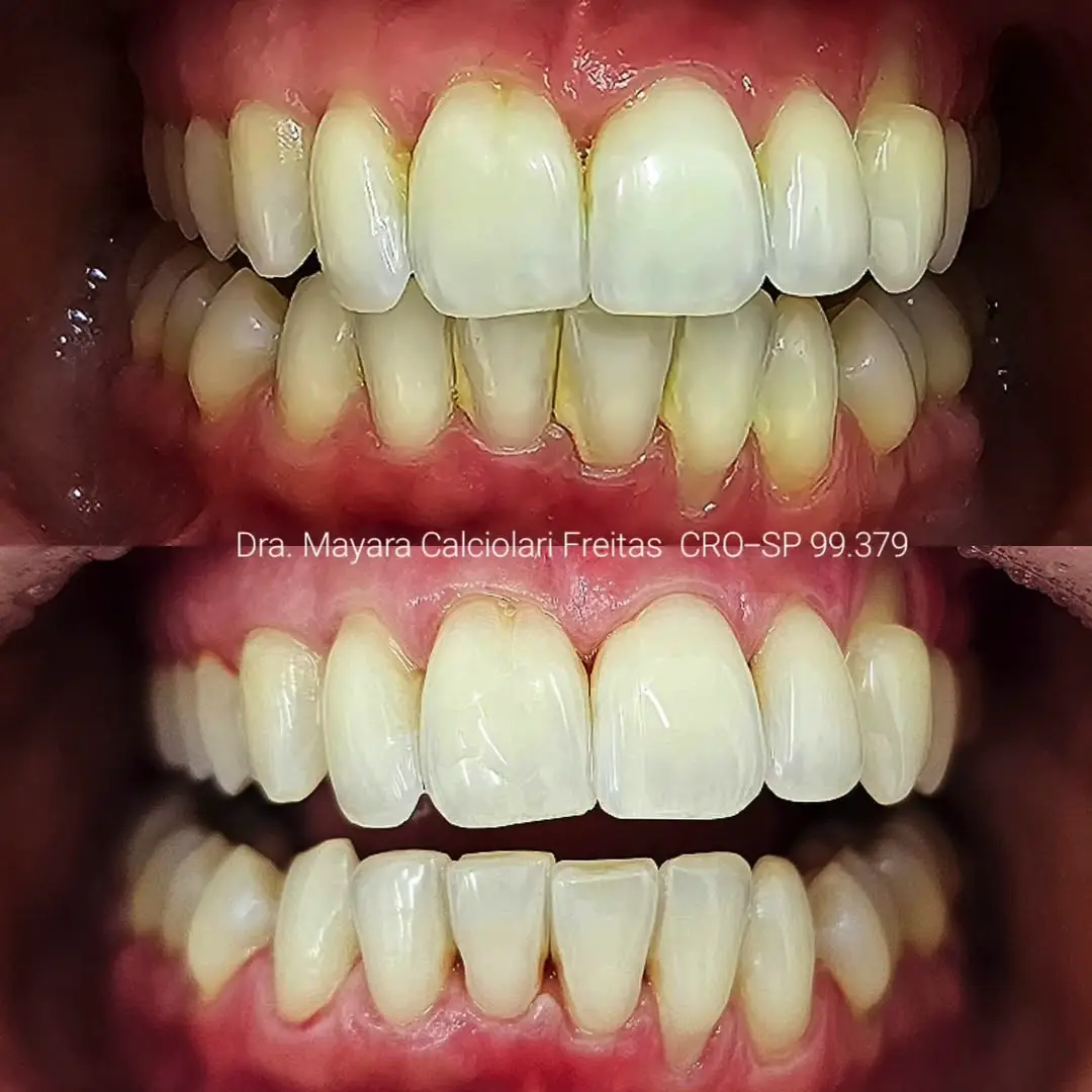 Dr-Mayara-Odontologia-Estetica6