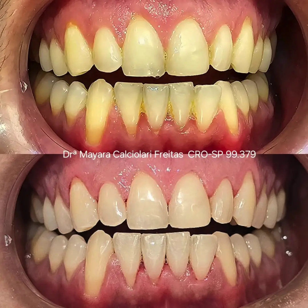 Dr-Mayara-Odontologia-Estetica7
