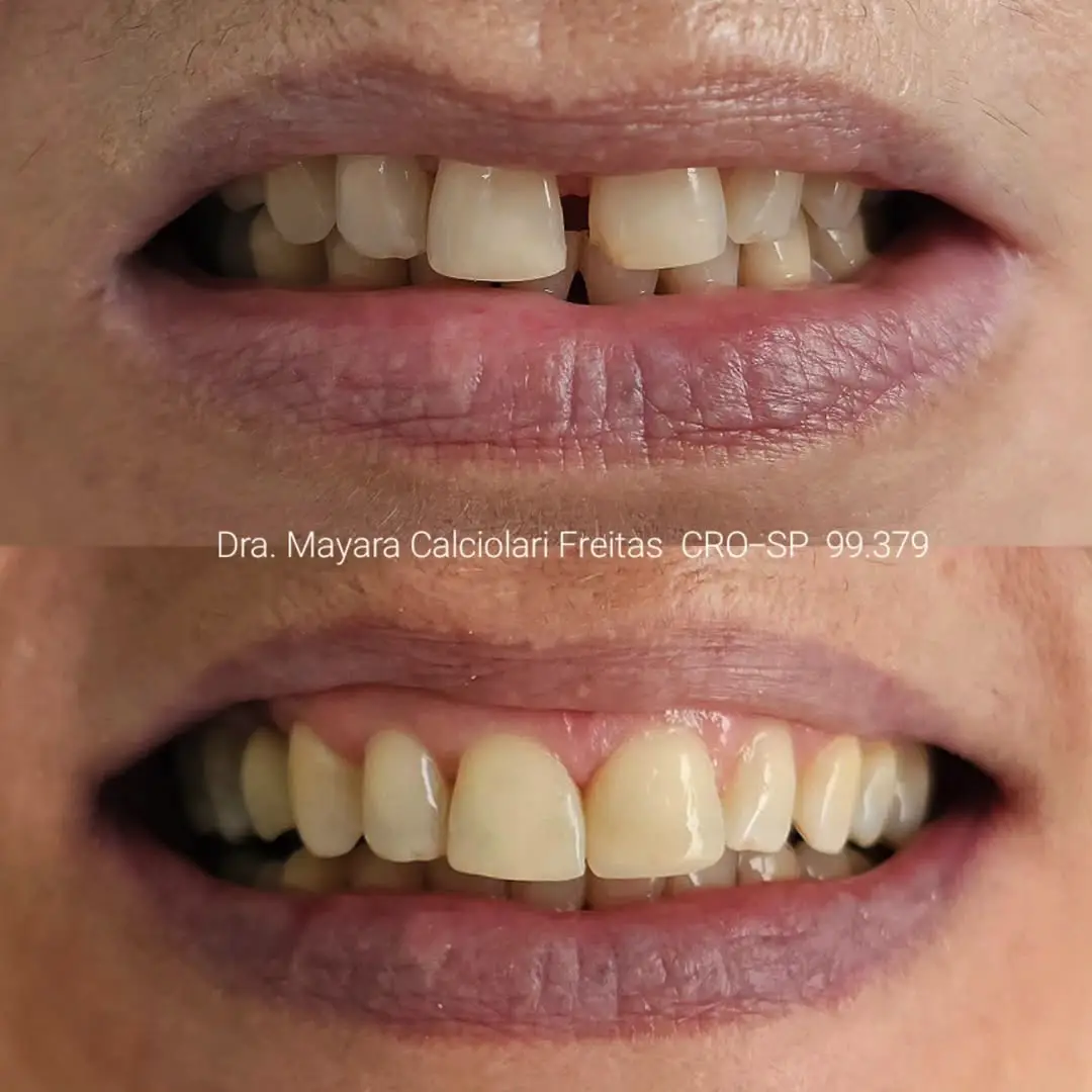 Dr-Mayara-Odontologia-Estetica8