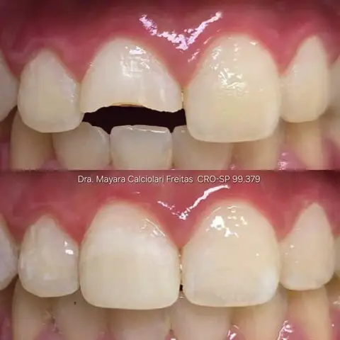 Dr-Mayara-Odontologia-Estetica9