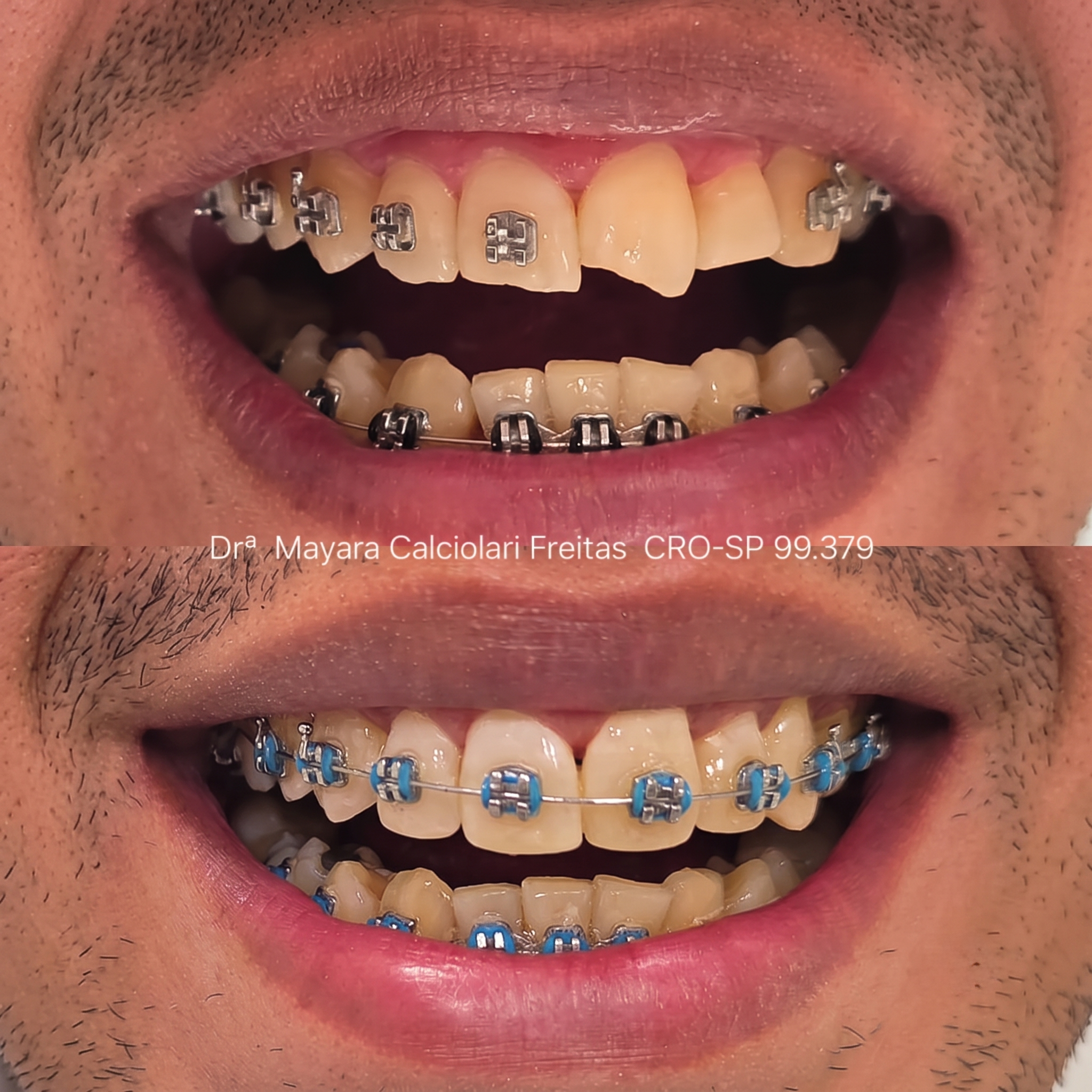 Dr-Mayara-Odontologia-Estetica4